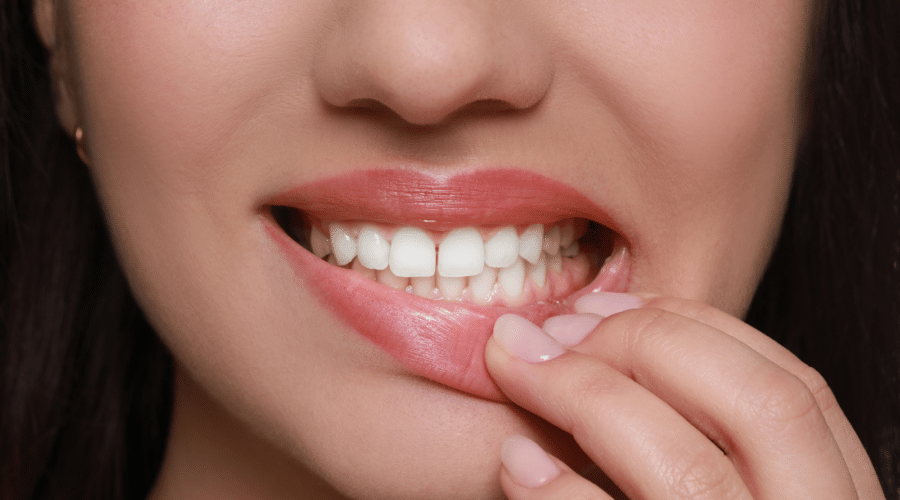 How Long Does It Take Gums To Heal After Implants blog