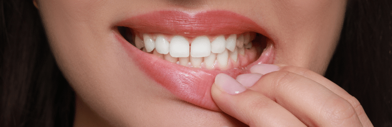 How Long Does It Take Gums To Heal After Implants?