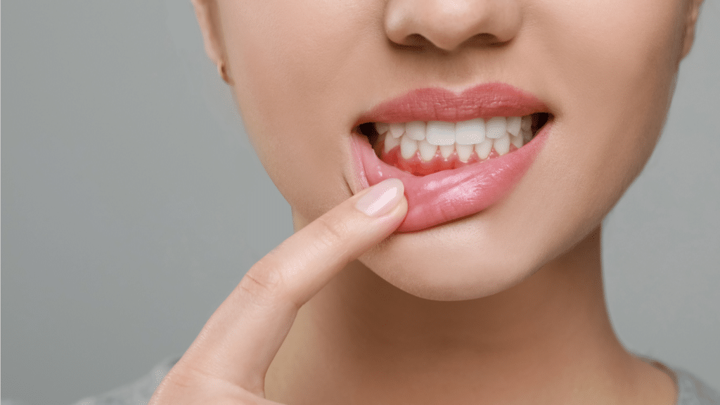 Non-Surgical Treatments for Gum Disease