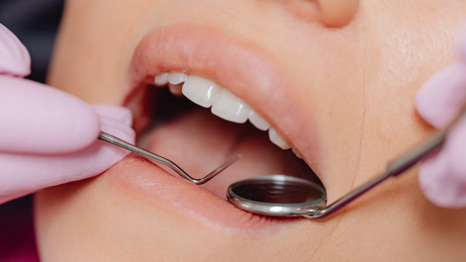 Tips and Techniques for Managing Gum Recession