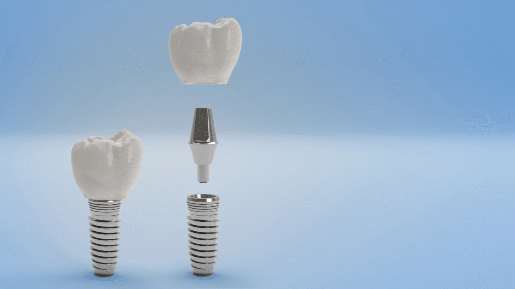 Maintaining dental implants